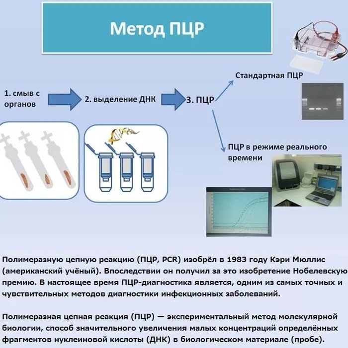 Streptococcus Agalactiae (стрептококк агалактия) в мазке у женщин. Что значит, лечение