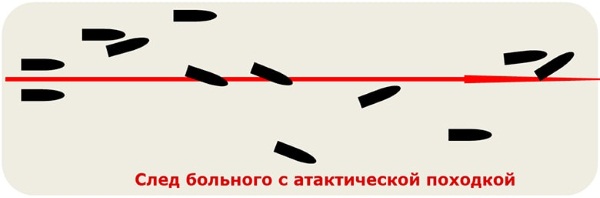 Вестибулопатический (вестибуло-атактический) синдром. Что это такое, как лечить