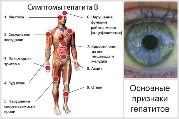 Заболевания печени у женщин. Причины, симптомы и лечение