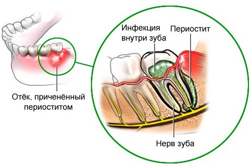 Антибиотики при флюсе зуба. Список, как принимать ребенку, взрослому