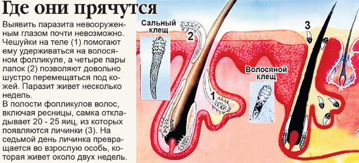 демодекс на ресницах лечение схема у человека