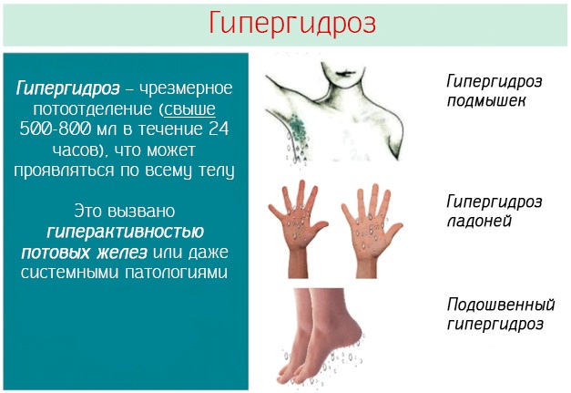 Демпинг-синдром. Что это такое в медицине