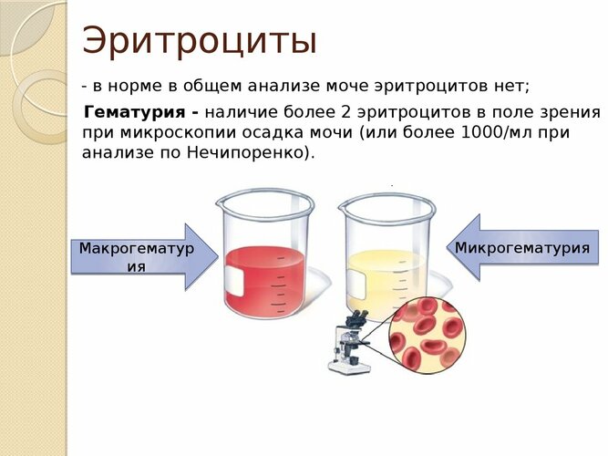 Норма эритроцитов в моче у женщин. Таблица, причины повышенных пониженных, лечение