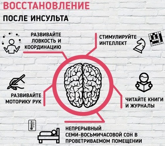 Ишемический инсульт. Последствия, неврология, лечение у взрослых, пожилых, детей, диагностика, восстановление