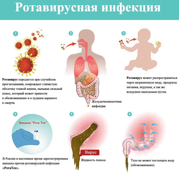 Ротавирусная инфекция у ребенка. Симптомы и лечение, диета, препараты