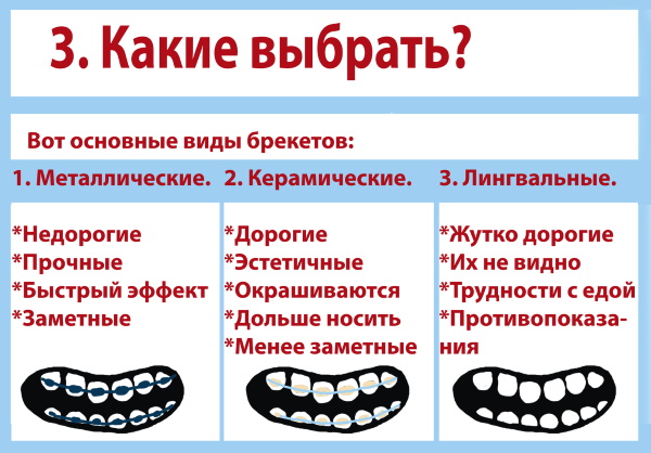 Брекеты на нижнюю, верхнюю, обе челюсти. Цены, установка, фото до и после