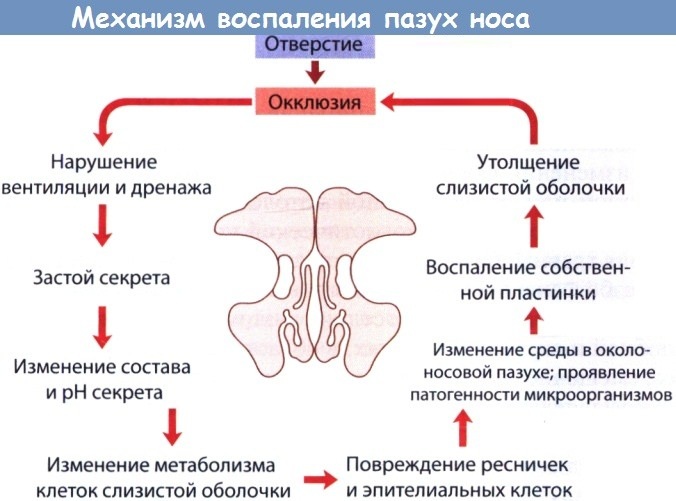 Фото черепа пазухи носа при гайморите thumbnail