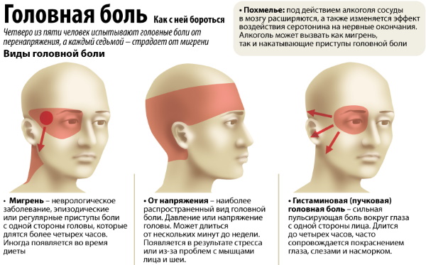 Головная боль и тошнота у женщин, при беременности. Причины, как избавиться