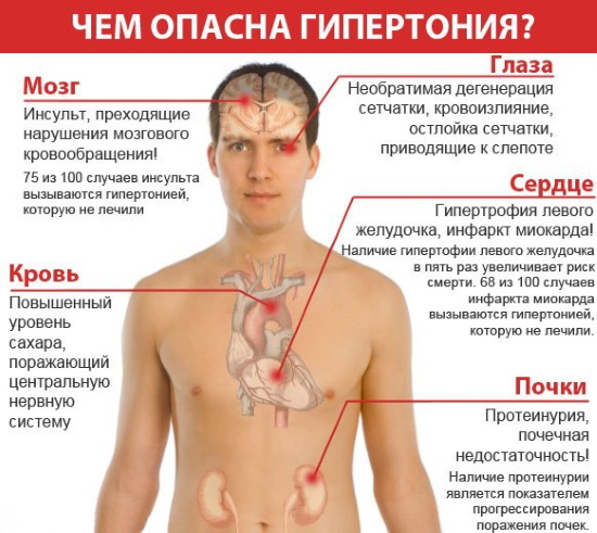 Головная боль и тошнота у женщин, при беременности. Причины, как избавиться