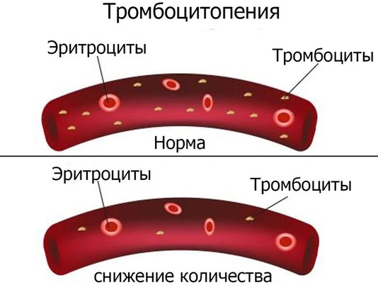 Как разводить Цефтриаксон Лидокаином (Новокаином), водой для внутримышечного введения инъекций. Инструкция по применению