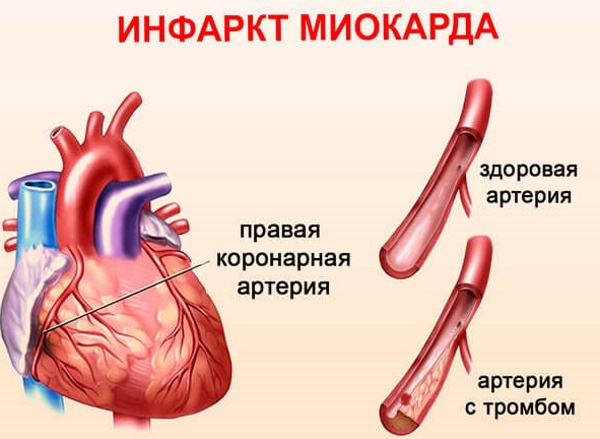 Как понизить кортизол у женщин. Препараты, народные средства без таблеток, список, названия, цены