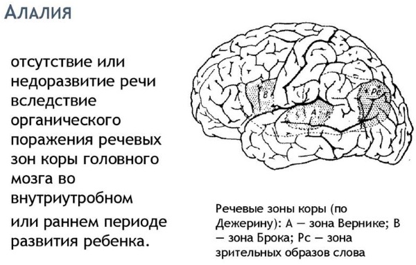 Последовательность постановки звуков в логопедии у детей. Таблица, схема