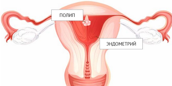 Матка у женщин. Где находится, строение, размер, фото, анатомия, болезни