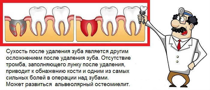 После удаления зуба фото по дням Удалили зуб когда можно пить