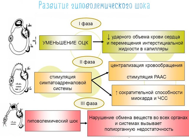 Эмболия околоплодными водами при кесаревом сечении. Причины, что это, прогноз и лечение