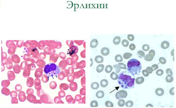 Клещевой моноцитарный эрлихиоз у человека. Анализ крови, симптомы и лечение