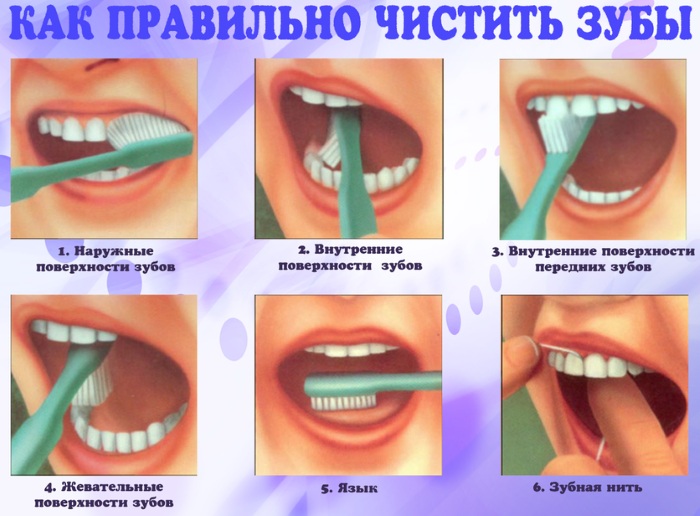 Флюс. Как лечить десны в домашних условиях содой, уксусом, солью. Быстрые способы