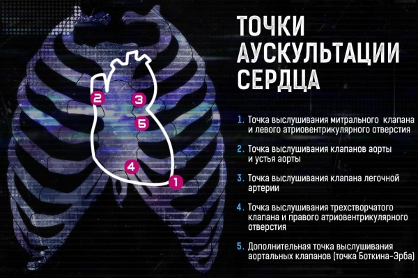 Гипертонический криз карта вызова скорой помощи