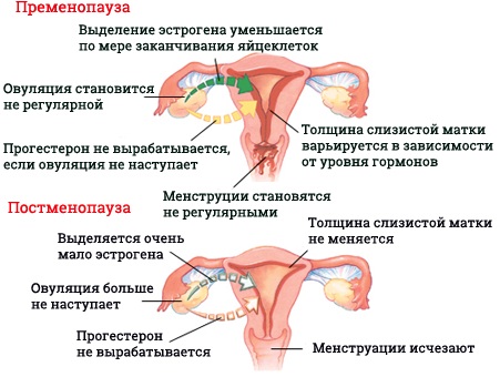 Климакс и беременность. Возможна ли после 50 лет, как распознать без месячных, признаки, тест