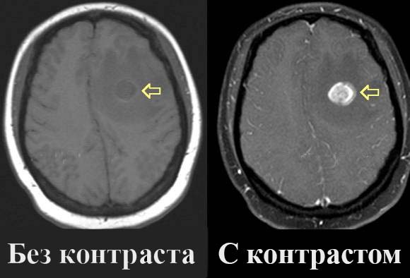 Вредно ли для здоровья МРТ? Противопоказания для детей, взрослых, беременных