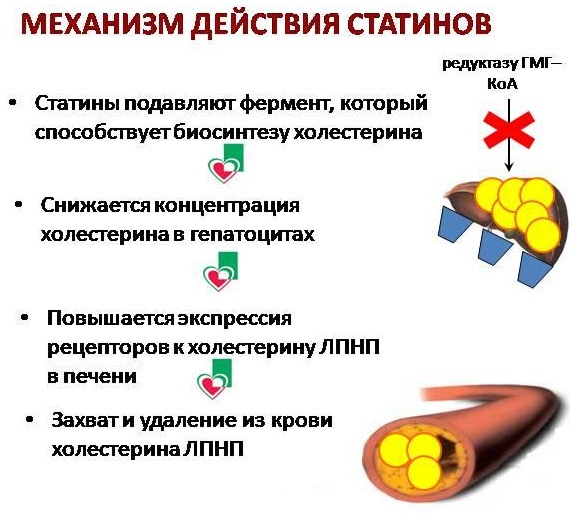 Препараты для чистки сосудов от холестерина и бляшек, травы, народные средства