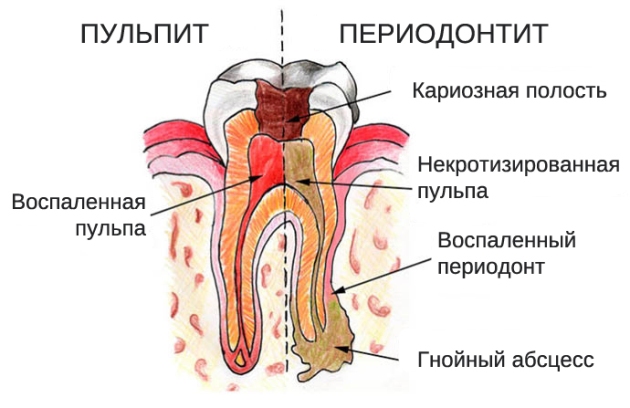 Стоматолог-терапевт. Что делает, чем занимается детский, взрослый