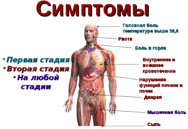 Геморрагическая лихорадка. Симптомы с почечным синдромом, что это такое, лечение