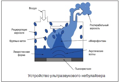 Компрессорные (компрессионные) ингаляторы небулайзеры детские, ультразвуковые домашние. Рейтинг