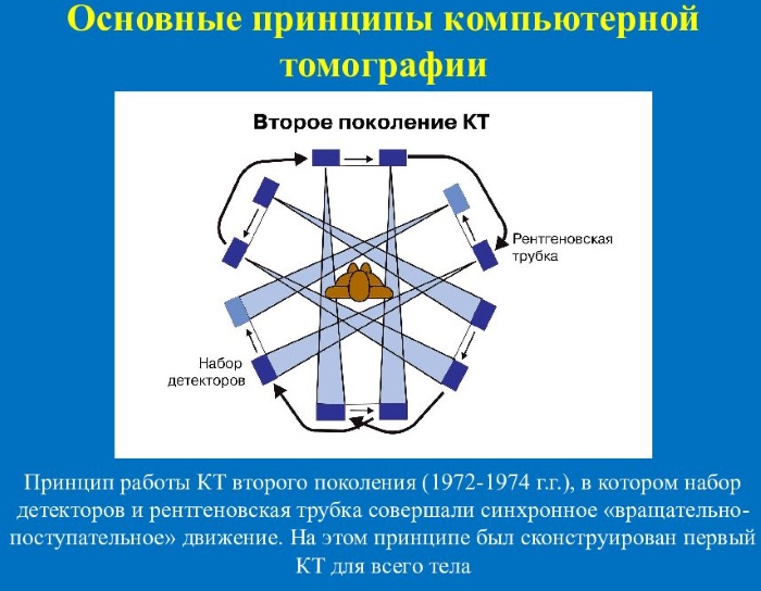 Компьютерная томография. Что это, разница с МРТ, противопоказания, виды