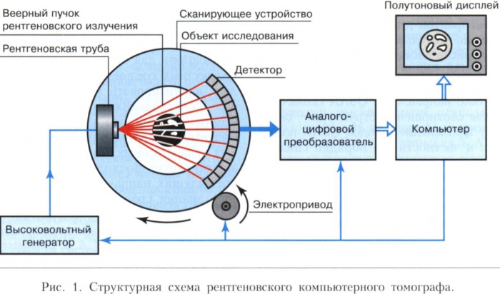 Компьютерная томография. Что это, разница с МРТ, противопоказания, виды