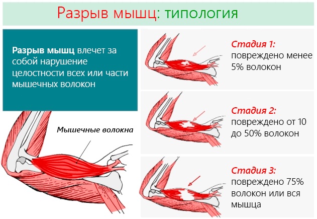 Мануальный терапевт. Что лечит у взрослых, детей, что делает