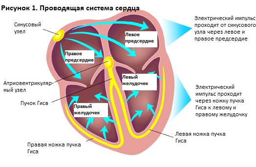 Нарушение внутрижелудочковой проводимости на ЭКГ у ребенка, подростка, взрослых. Что это значит