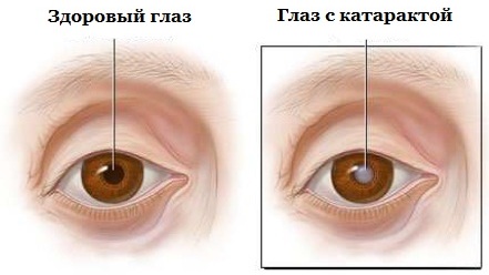 Офтан Катахром (Oftan Catachrom) или Тауфон (Taufonum). Что лучше, совместимость