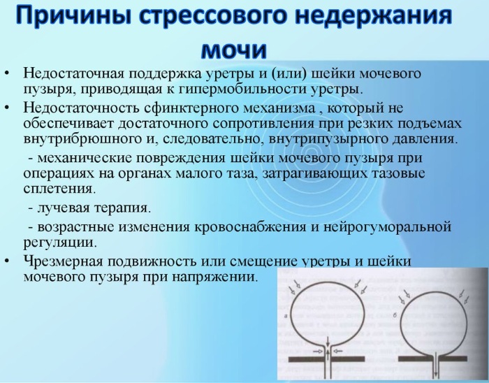 При чихании выделяется моча. Что делать, причины, лечение у женщин, мужчин, к какому врачу обратиться