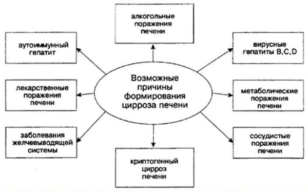 Цирроз печени. Симптомы у женщин, мужчин, диагностика, причины, лечение препаратами