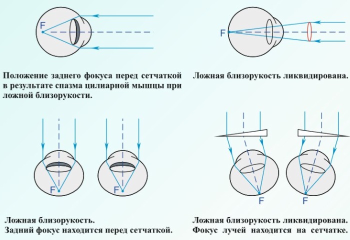 Визотроник для глаз. Отзывы, что он делает, где купить, цена процедуры