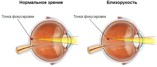 Визотроник для глаз. Отзывы, что он делает, где купить, цена процедуры