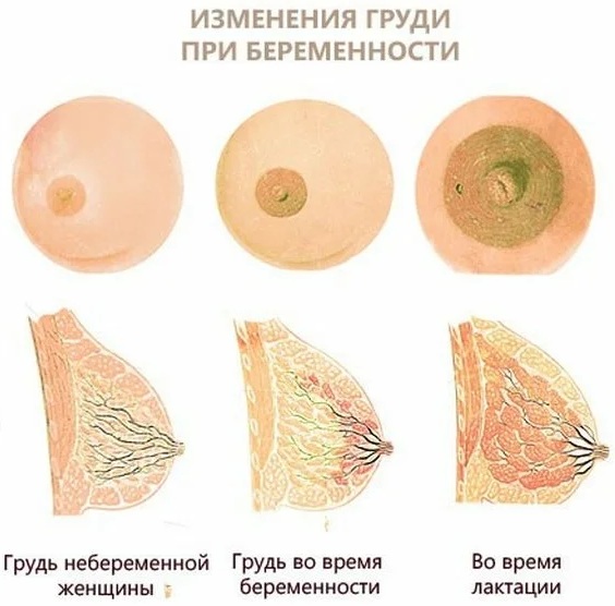 Болит грудь перед месячными, сильно набухает. Почему, что делать