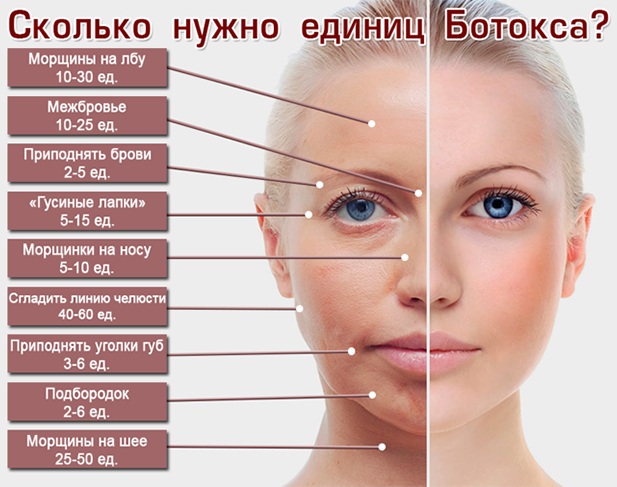 Ботулинотерапия. Механизм действия в неврологии, косметологии, что это, цена