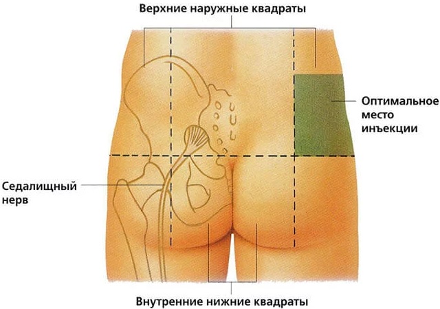 Депо-Провера (Depo-Provera). Отзывы женщин, инструкция по применению, дозировка, цена