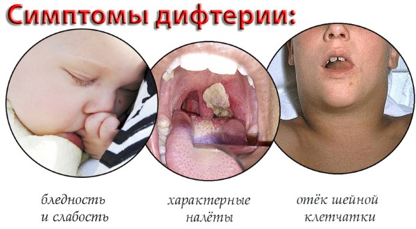 Гортань и глотка. Анатомия, строение, функции, заболевания