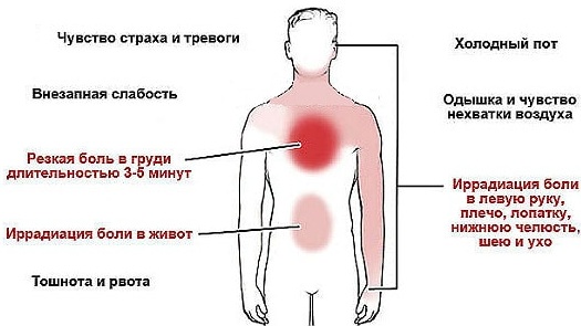 Ишемическая болезнь сердца. Симптомы и лечение, признаки, рекомендации