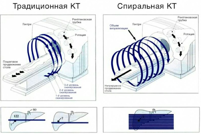 МСКТ брюшной полости с контрастированием. Что это, подготовка к исследованию, что показывает, как проводится, цена