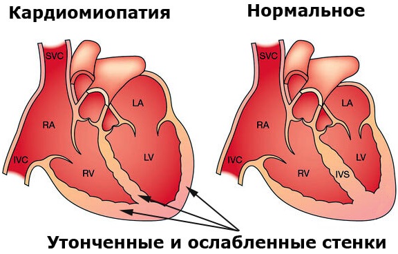 Нервно-мышечные заболевания. Классификация, этиология, неврология, наследственные, хронические. Симптомы и лечение у детей, взрослых