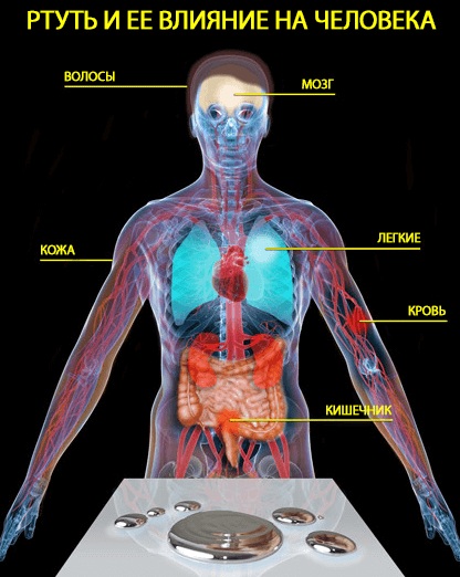 Отравление парами ртути. Симптомы, лечение, первая помощь, последствия