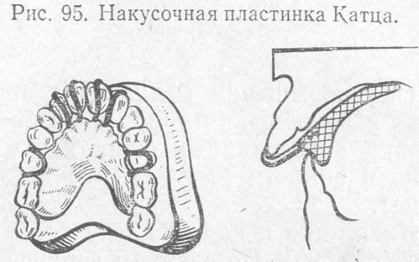 Стоматолог-ортодонт. Что делает детский, взрослый