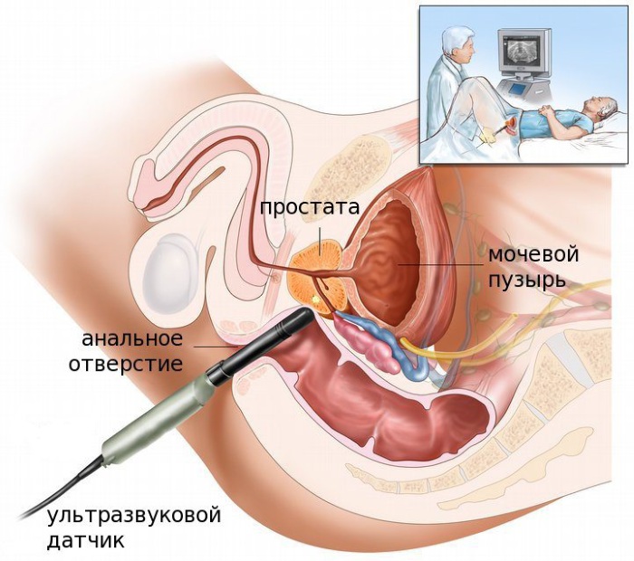 ТРУЗИ. Подготовка к исследованию предстательной железы, мочевого пузыря, расшифровка результатов