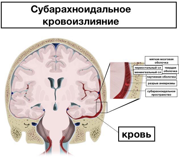 ВЖК 1-2-3 степени у новорожденных. Что это такое, фото, лечение, последствия