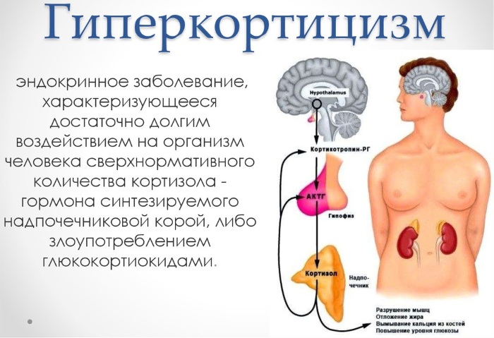 Буденит Стери-Неб (Budenit Steri-Neb) для ингаляций. Инструкция по .