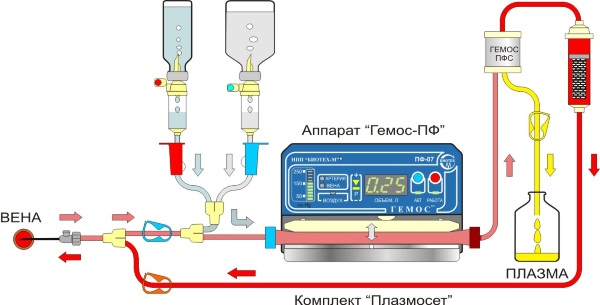 Чистка крови плазмаферез. Цена, что это такое, показания, противопоказания